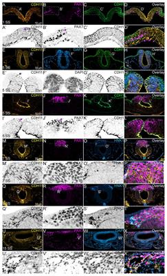 Cadherin-11 Is Required for Neural Crest Specification and Survival